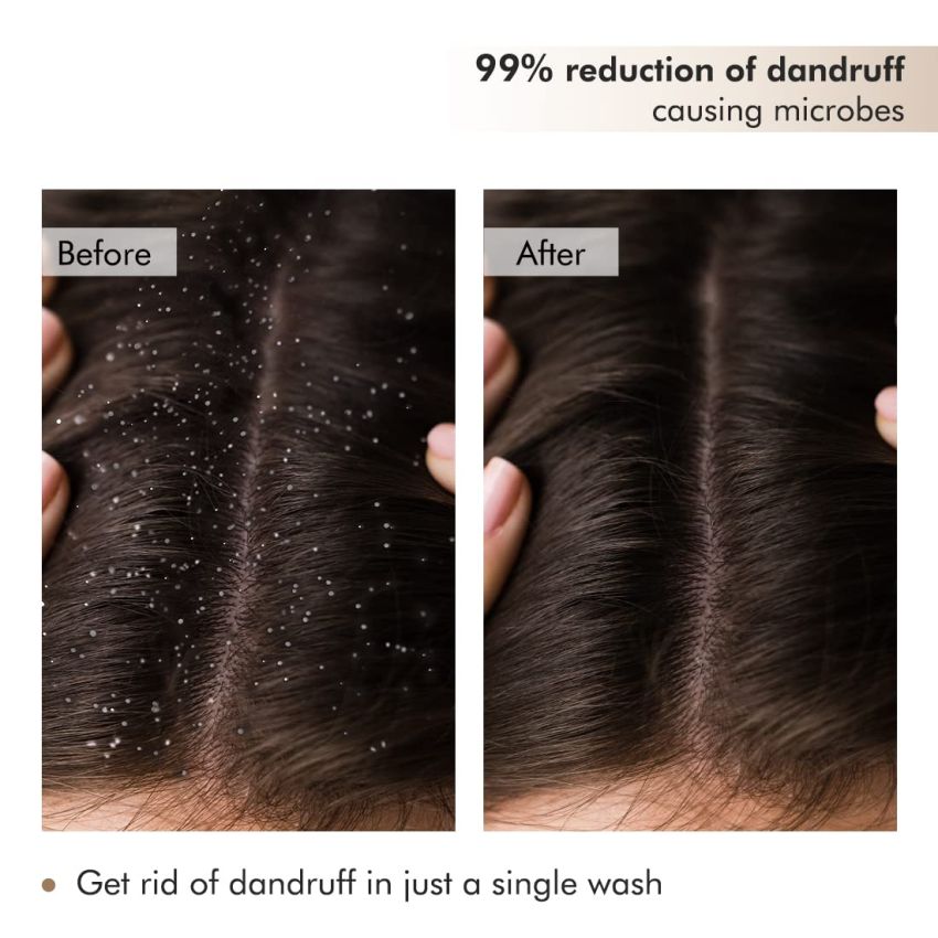 mCaffeine Anti Dandruff Coffee Scalp Scrub - 99% Dandruff Control Treatment for Men & Women | Scalp Exfoliator & Dandruff Remover | For Itchy Scalp in Hot & Humid Weather- 250gm