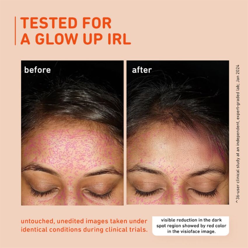 Plum 15% Vitamin C Serum for Glowing Skin | for Oily, Dry & Combination Skin | Reduce Pigmentation & Dark Spot |with Mandarin | Non-Irritating, Hydrating & Soothing | Face Serum for Men & Women | 10ml