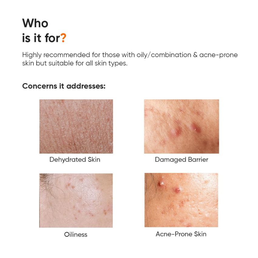 Minimalist Dehydrated Skin Moisturizer with 10% Vitamin B5 for Oily & Acne-Prone Skin | Oil-Free Hydration & Formula for Damaged Barrier Repair | Fast-Absorbing & Non-Sticky Lightweight Winter Cream For Women & Men | Fragrance-Free | 50 grams
