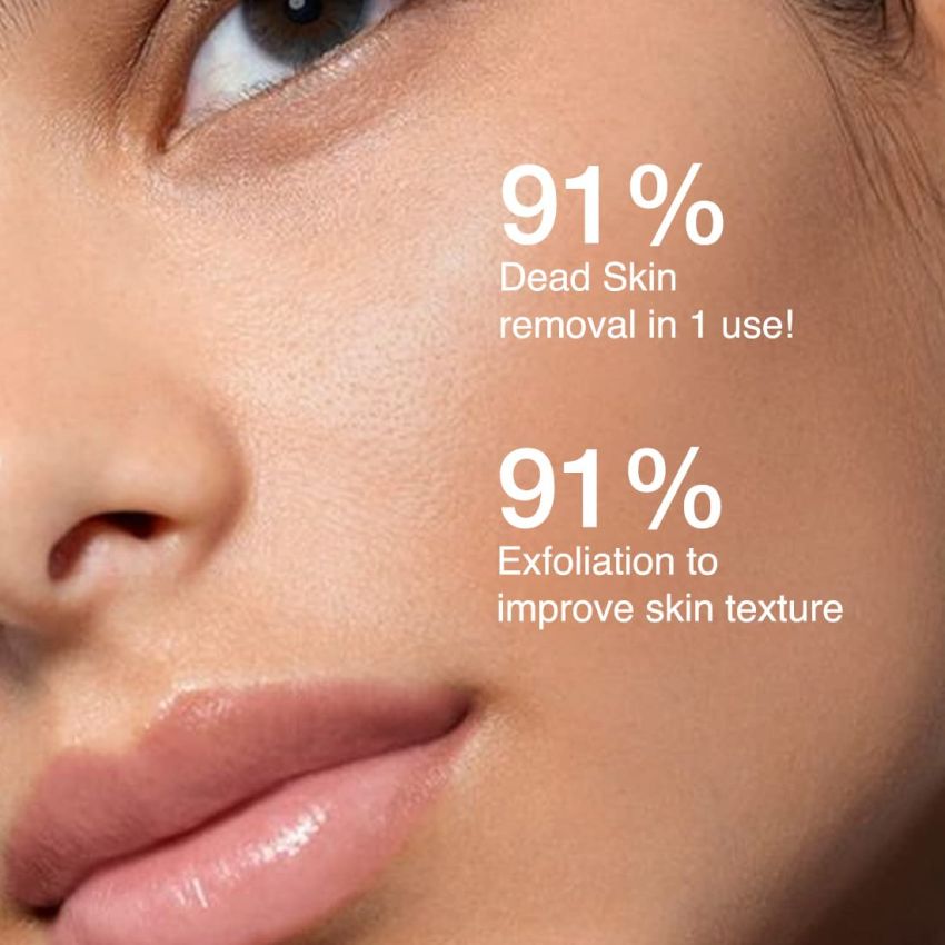 mCaffeine Exfoliating Peel Serum with 25% AHA, 2% BHA, 5% PHA | Glycolic Acid & Salicylic Acid Serum For Blackheads & Whiteheads | Improves Skin Texture | For All Skin Types - 30 ml