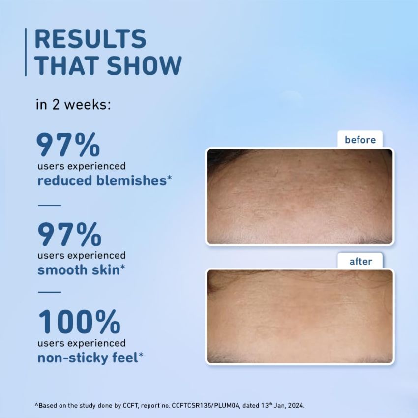 Plum 10% Niacinamide Serum with Rice Water | Provides Clear, Glowing & Brightening Skin | for Acne Prone, Combination, Oily & Sensitive Skin | Oil Control & Anti Acne Face Serum for Women & Men | 30ml